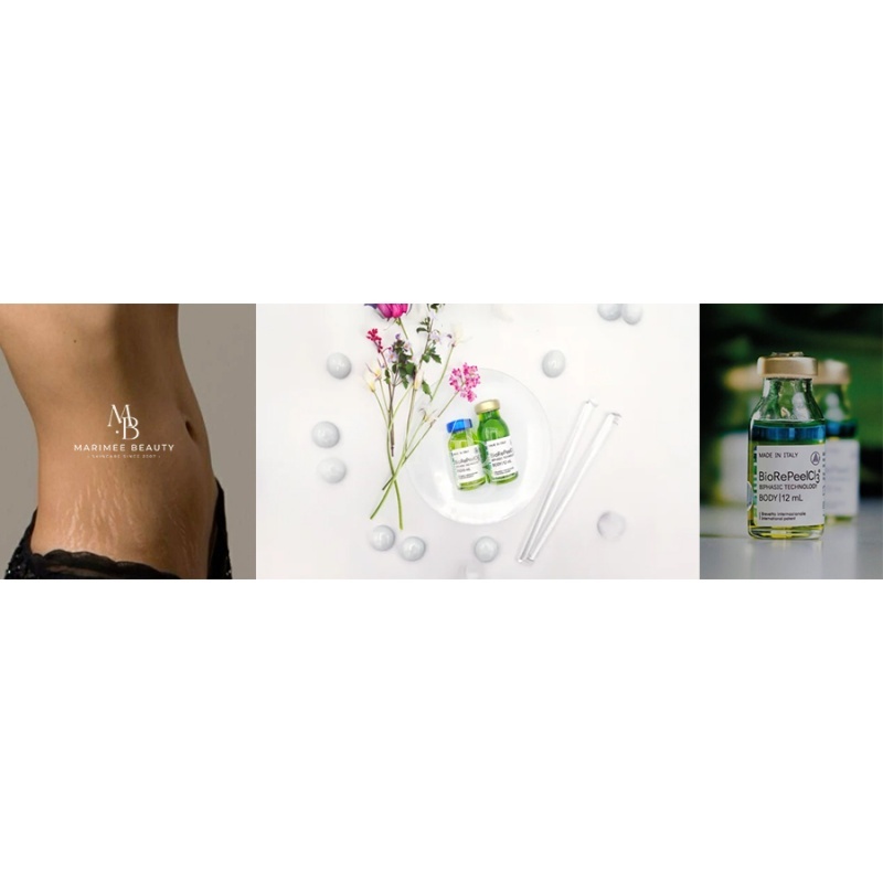 Biorepeel kehale koos mikroneedlinguga-marimee beauty.JPG